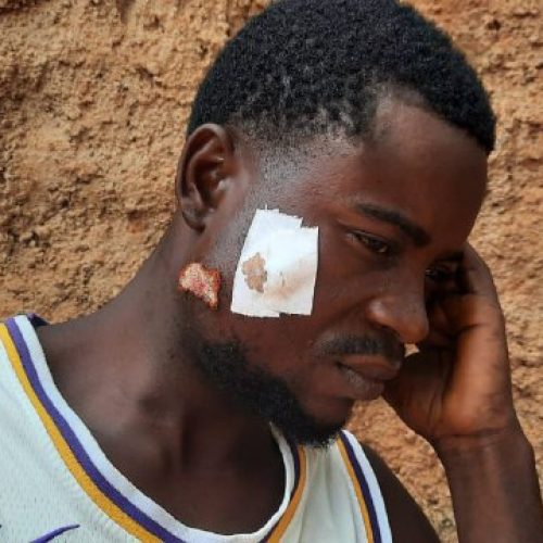 Efectivo da Polícia dispara à queima-roupa contra garimpeiros em Cafunfo