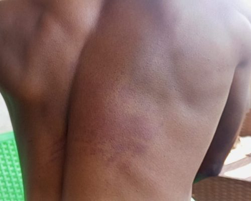 Seguranças “Capacete Azul” acusados de espancar cidadão por suspeita de prática do garimpo no Luremo