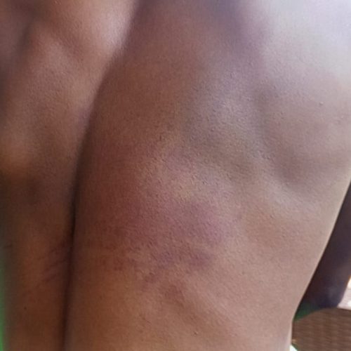 Seguranças “Capacete Azul” acusados de espancar cidadão por suspeita de prática do garimpo no Luremo