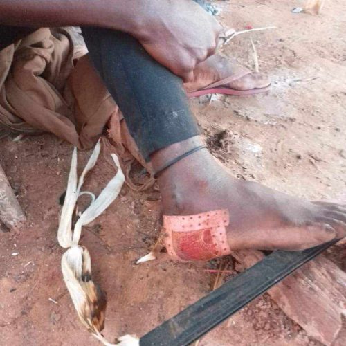 Lunda-Norte: Granada lançada por agentes da Polícia faz dez feridos em Capenda-Camulemba