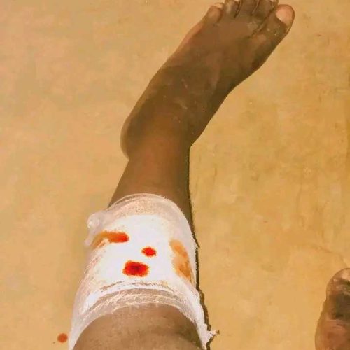 HRW preocupada com fome infantil e violência policiais em Angola