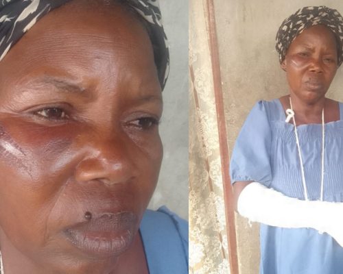 Polícia no Camama acusada de proteger fiscais que agrediram zungueiras no Calemba 2