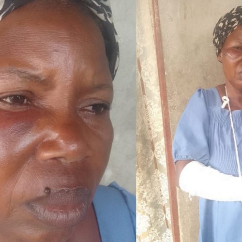 Polícia no Camama acusada de proteger fiscais que agrediram zungueiras no Calemba 2