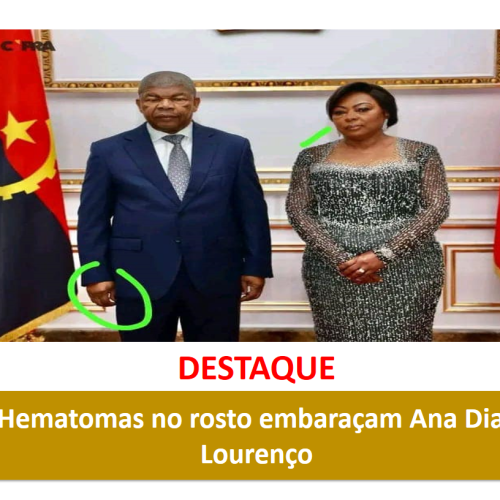 Hematomas no rosto embaraçam Ana Dias Lourenço